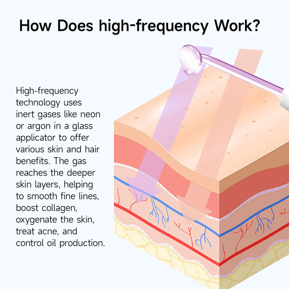 Vyntraas - High Frequency Wand